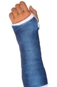 broken arm in blue cast